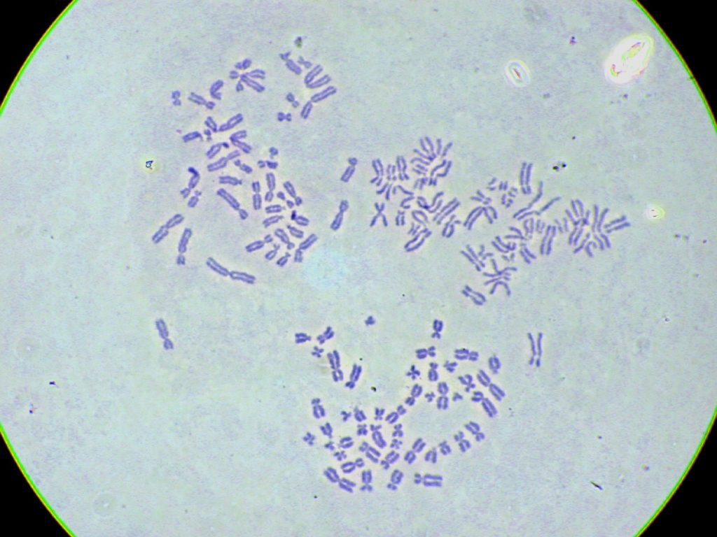 Metaphase chromosomes stained purple, spread out on a slide