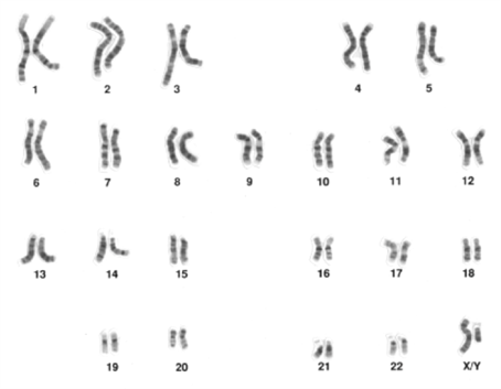 Picture of a karyogram showing 23 pairs of chromosomes in black and white